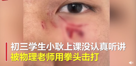 陕西15岁男生遭老师殴打缝16针,恶意殴打未成年学生怎么办?